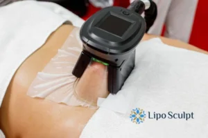 Cryolipolysis Helping You Getting that Perfect Summer Body 3 Cryolipolysis Market Drayton can give you the best summer body - contact us today!