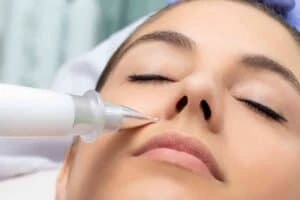Best Actinic Keratoses Removal 3 Actinic keratoses Market Drayton solutions - book in today!